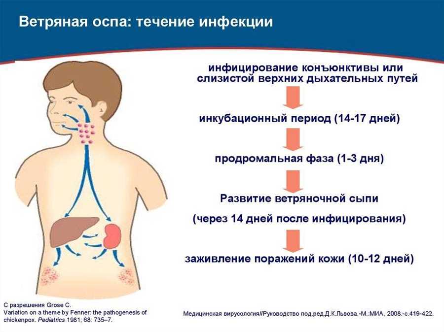 Заразен ли взрослый если ребенок болеет ветрянкой